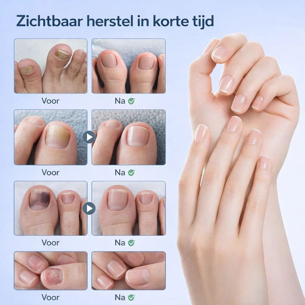 NailRestore – Herstel je nagels zichtbaar van binnenuit